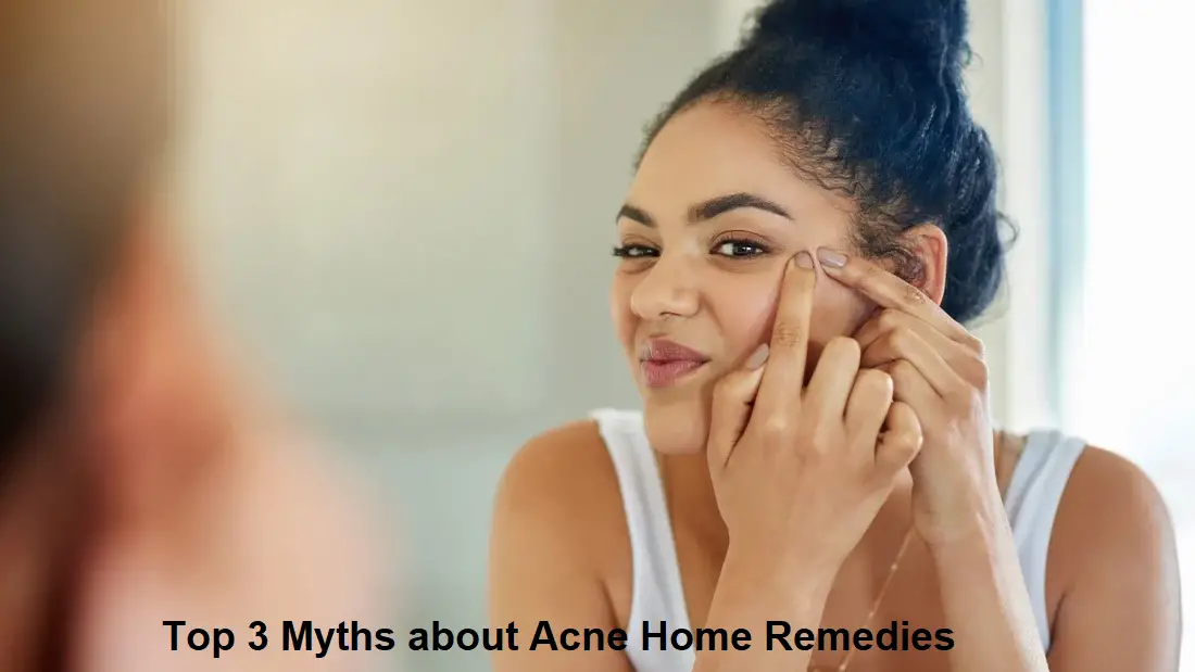 Top 3 Myths about Acne Home Remedies